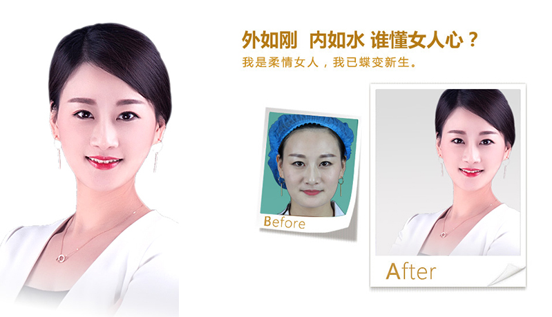 本溪V脸、线雕隆鼻